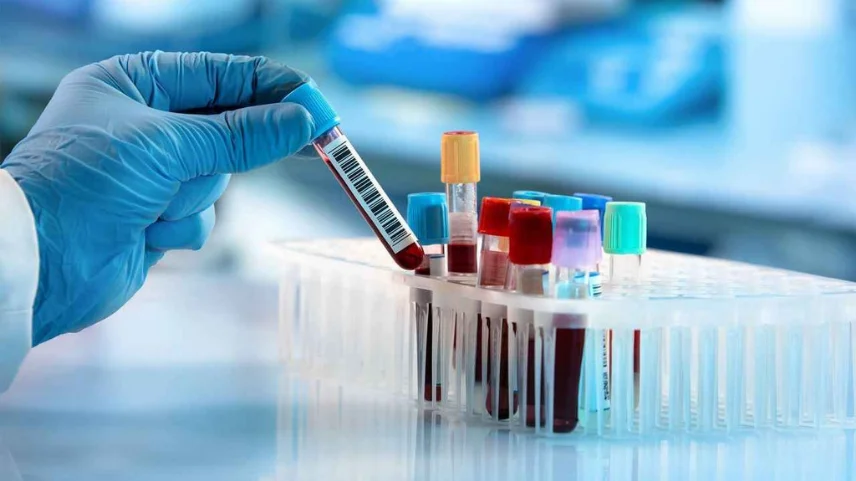Eşcinsel Erkekler Arasında Mpox Vakaları Artıyor: Küresel Salgın Endişesi