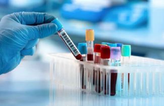 Eşcinsel Erkekler Arasında Mpox Vakaları Artıyor: Küresel Salgın Endişesi